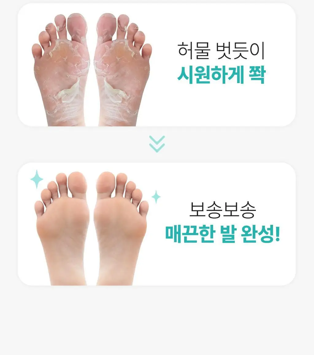 [발허물팩] 아리얼 스무스 앤 퓨어 풋 필링 마스크 2입 7종 택1 상세페이지 103